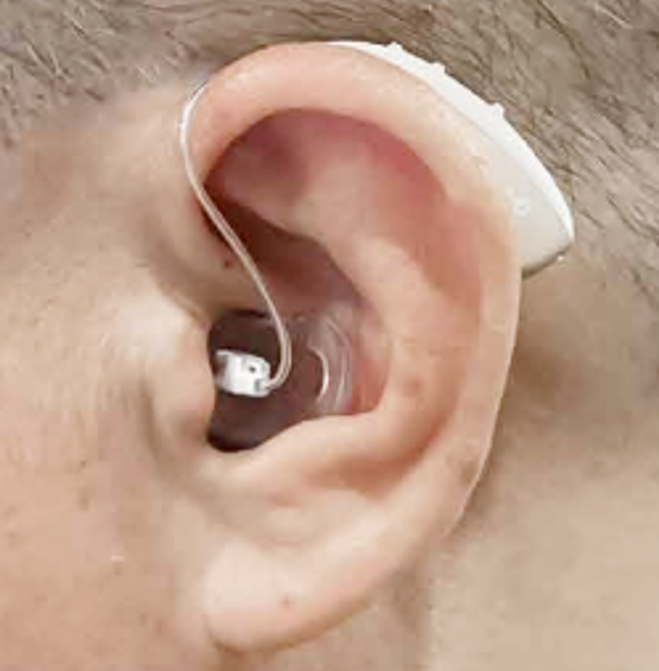 Tingoton Adds UltraFit RIC and BTE Earmolds