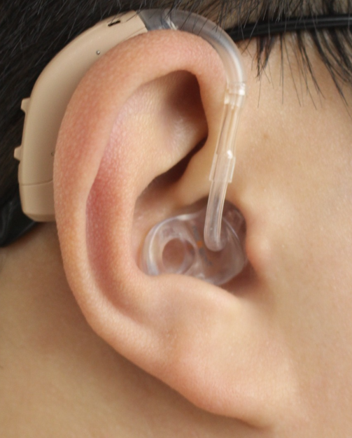 Tingoton Adds UltraFit RIC and BTE Earmolds