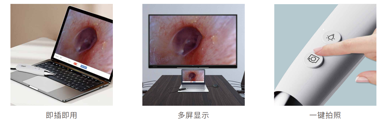 智影高清耳镜-杭州听工场科技有限公司