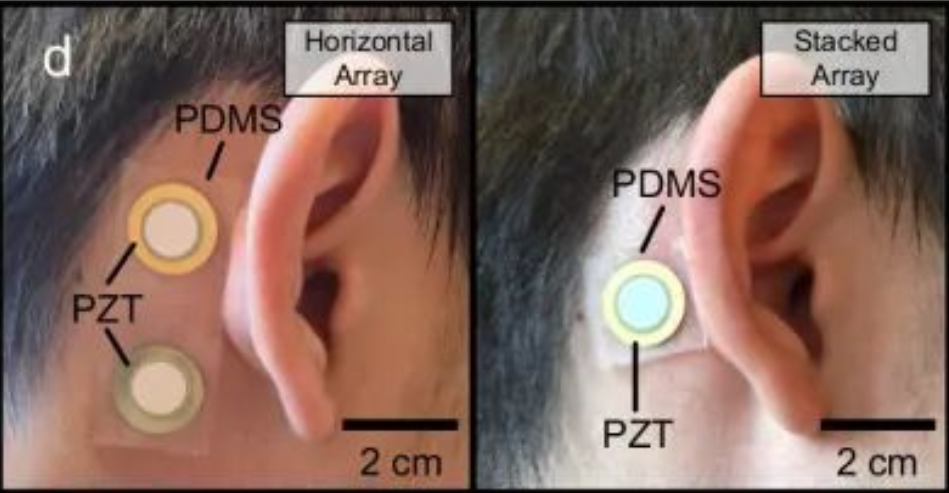 Flexible Skin-Mounted Device Explored for Conductive Hearing Loss